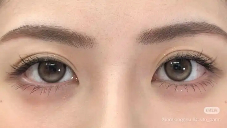 Dilema Softlens: Antara Ingin Tampil Percaya Diri dan Risiko Kesehatan Mata