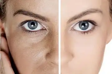 Mengapa Kulit Terlihat Kusam Meski Sudah Rajin Skincare?