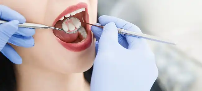 Kenapa Cek Gigi Itu Penting
