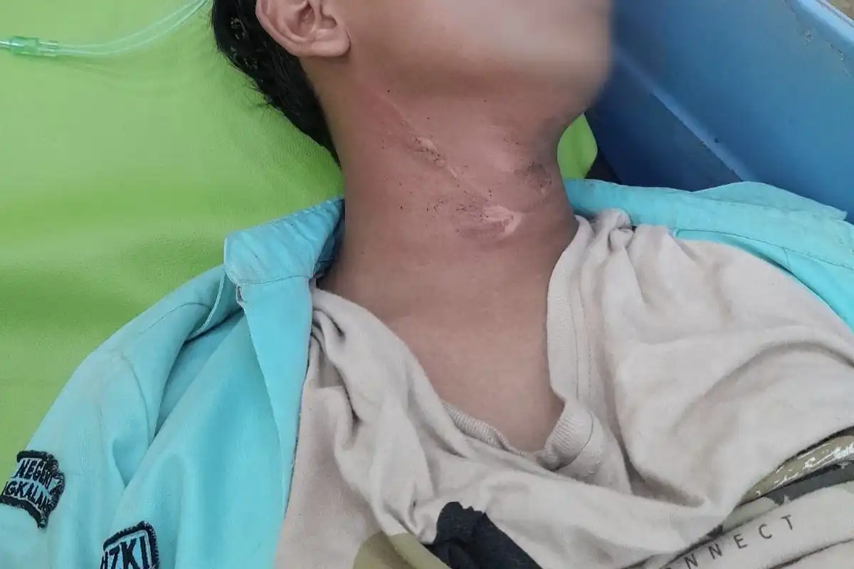 Leher Siswa SMA Terjerat Kabel PLN di Bangkalan