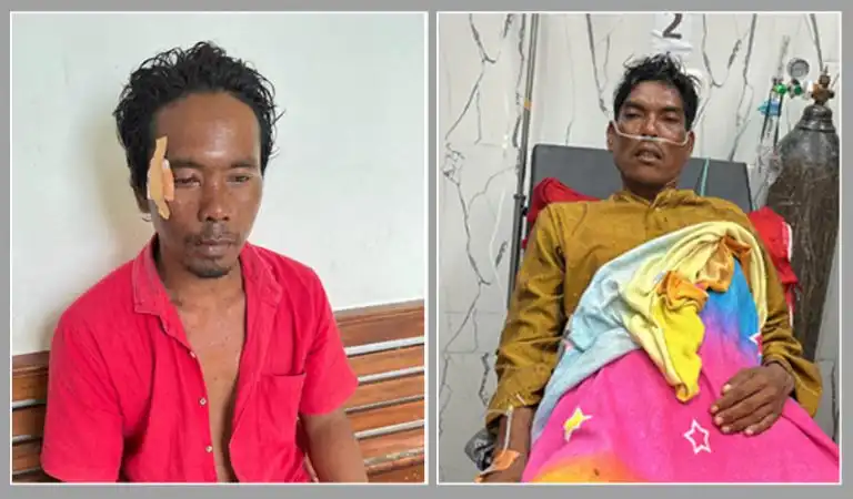 3 Nelayan Pulau Mandangin Sampang Tersambar Petir