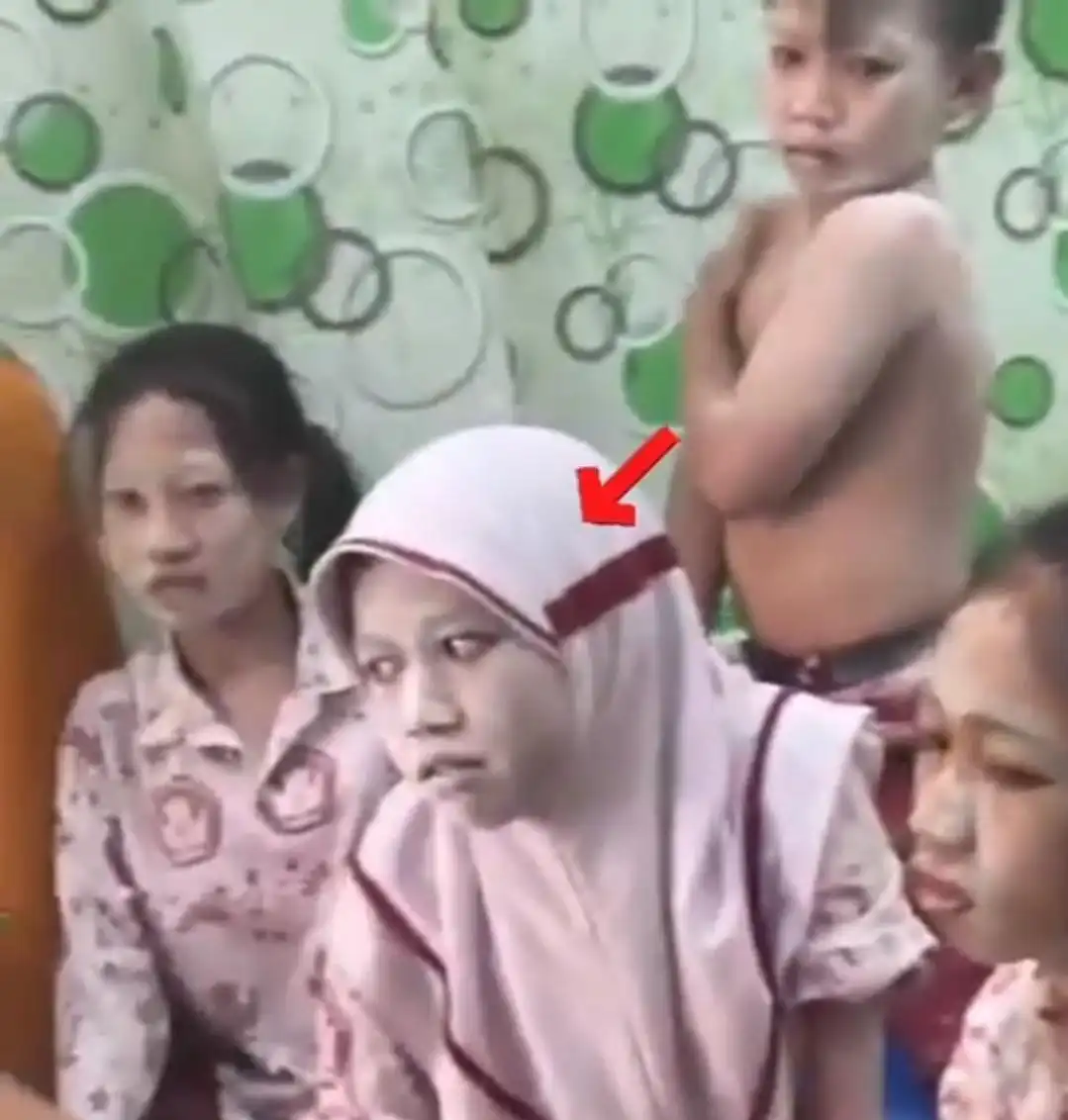 Satgas MBG Tunggu Hasil Lab Kasus Siswa Gatal-Gatal Massal di Sampang