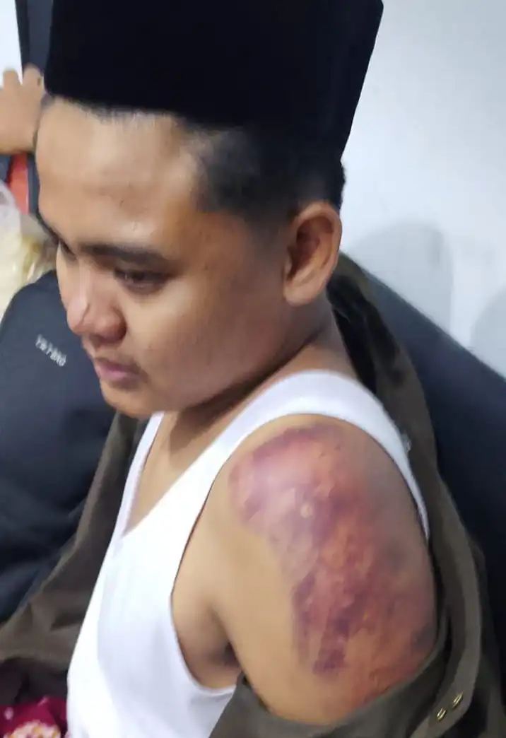 Guru Madrasah di Sampang Dianiaya Dua Pria Bersenjata Celurit, Korban Dirawat Intensif