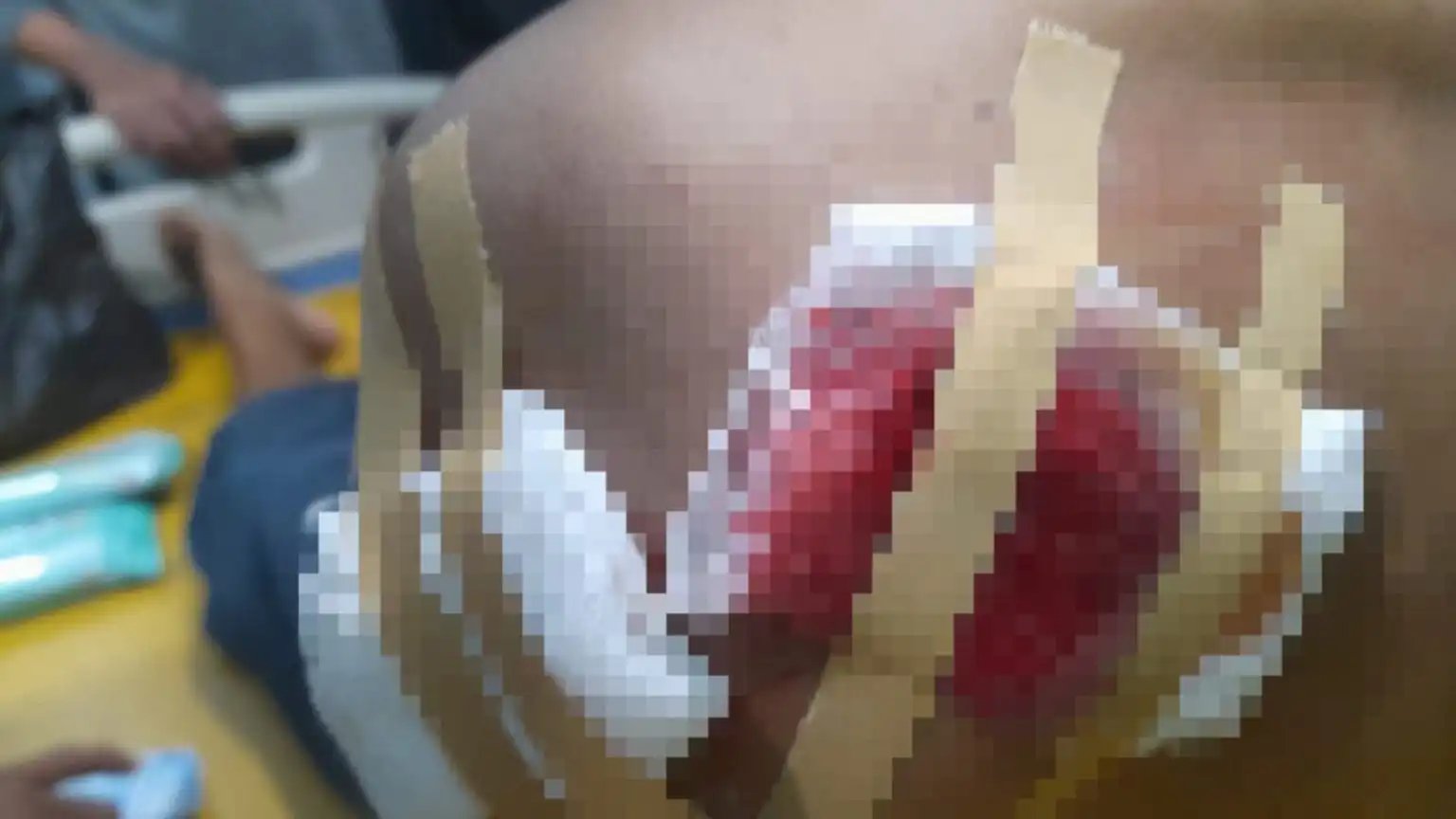 Pria di Pamekasan Bacok Warga, Diduga Akibat Cemburu