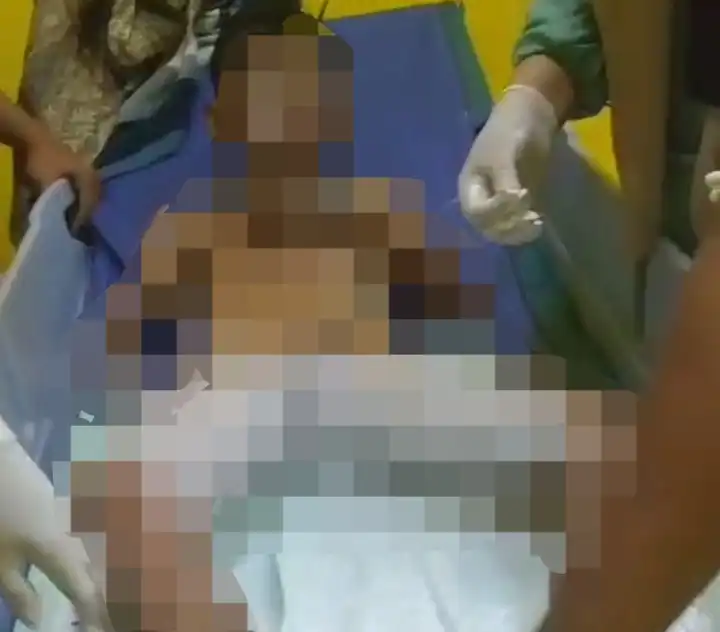 Gegara Main Petasan Kalengan, 2 Warga  Sampang Alami Luka Bakar