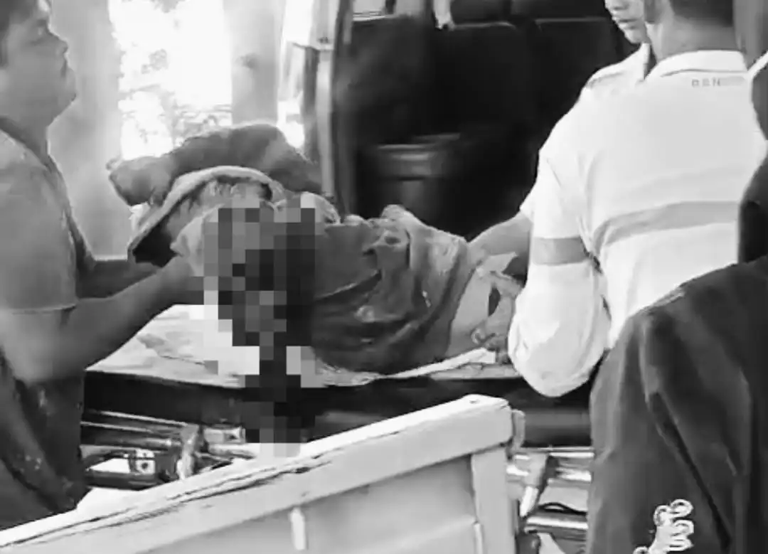 Nahas! Pickup Tabrak Fuso Saat Diduga Menyalip, Tangan Pengemudi di Sampang Putus