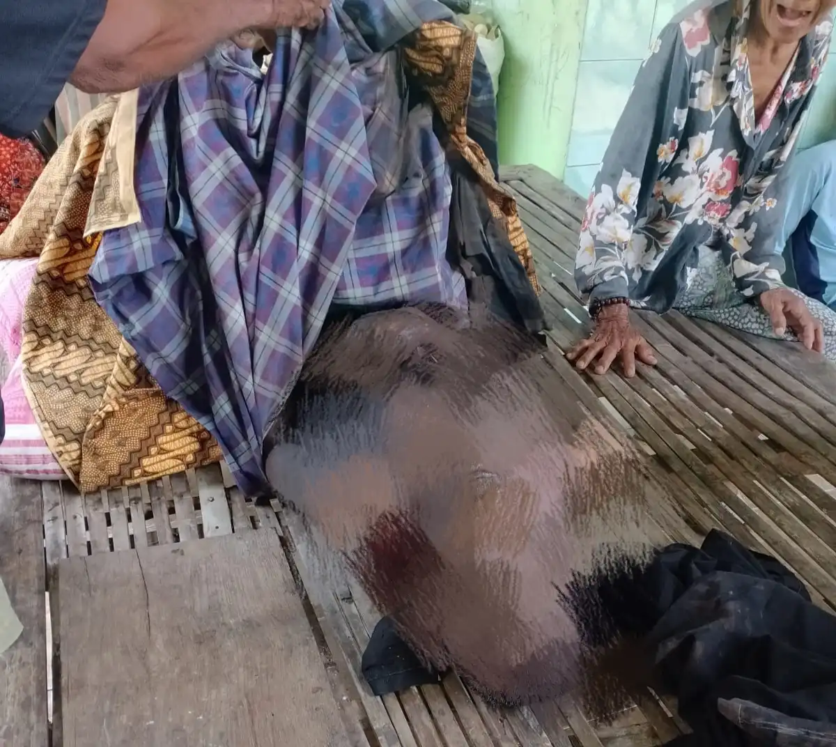 Lansia Lumpuh di Sampang Tewas Terpanggang Akibat Korsleting Listrik pada Penanak Nasi