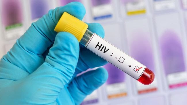 Perilaku Seks Tidak Aman, Penyebab Utama Penyebaran HIV/AIDS di Sampang