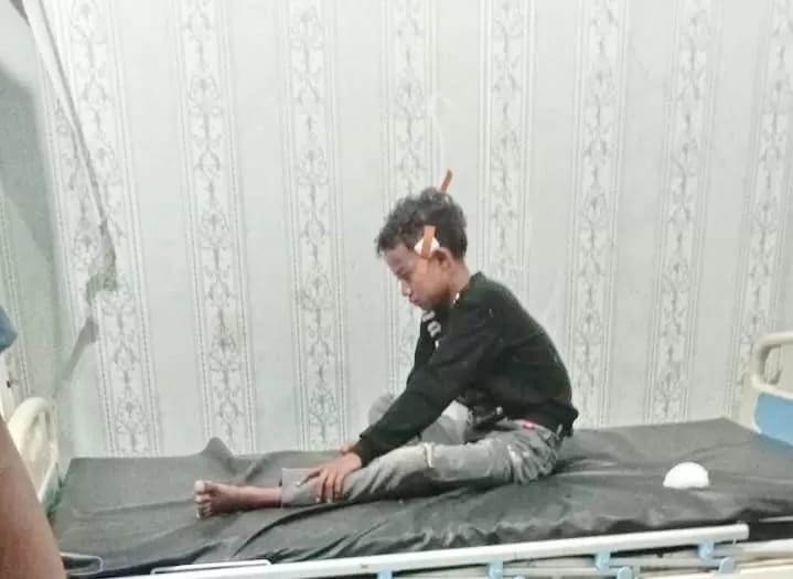 Suporter Persis Solo Berulah, Fasilitas Puskesmas dan Warga Sampang Jadi Korban