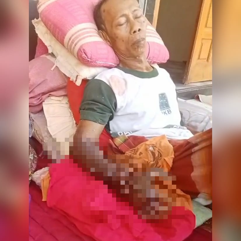 Kakek di Bangkalan Digigit Ular Viper, Tangan Bengkak dan Melepuh