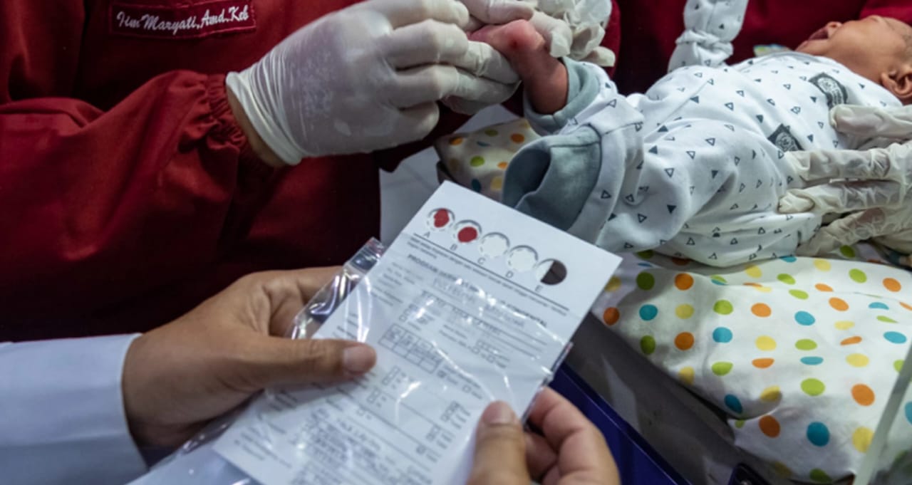 Dinkes Sampang Targetkan 9.000 Bayi Jalani Skrining Hipotiroid Kongenital
