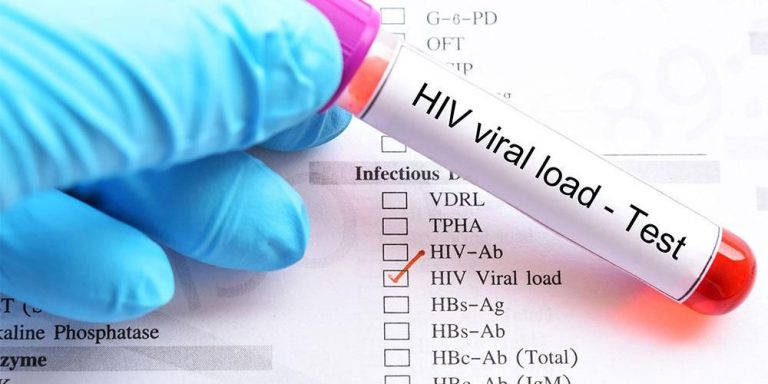 Kasus HIV di Sampang Turun 52 Persen, Dinkes-KB Gencarkan Edukasi dan Tes Dini