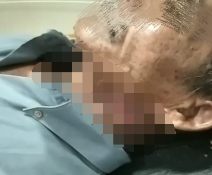 5 Bulan Tanpa Kabar, Kuasa Hukum Korban Nilai Polres Sampang Tak Serius Tangani Kasus Penganiayaan