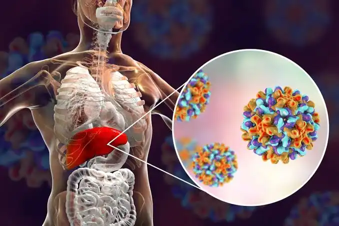 Jangan Keliru! Ini Perbedaan Nyata Antara Hepatitis A, B, C, D, dan E