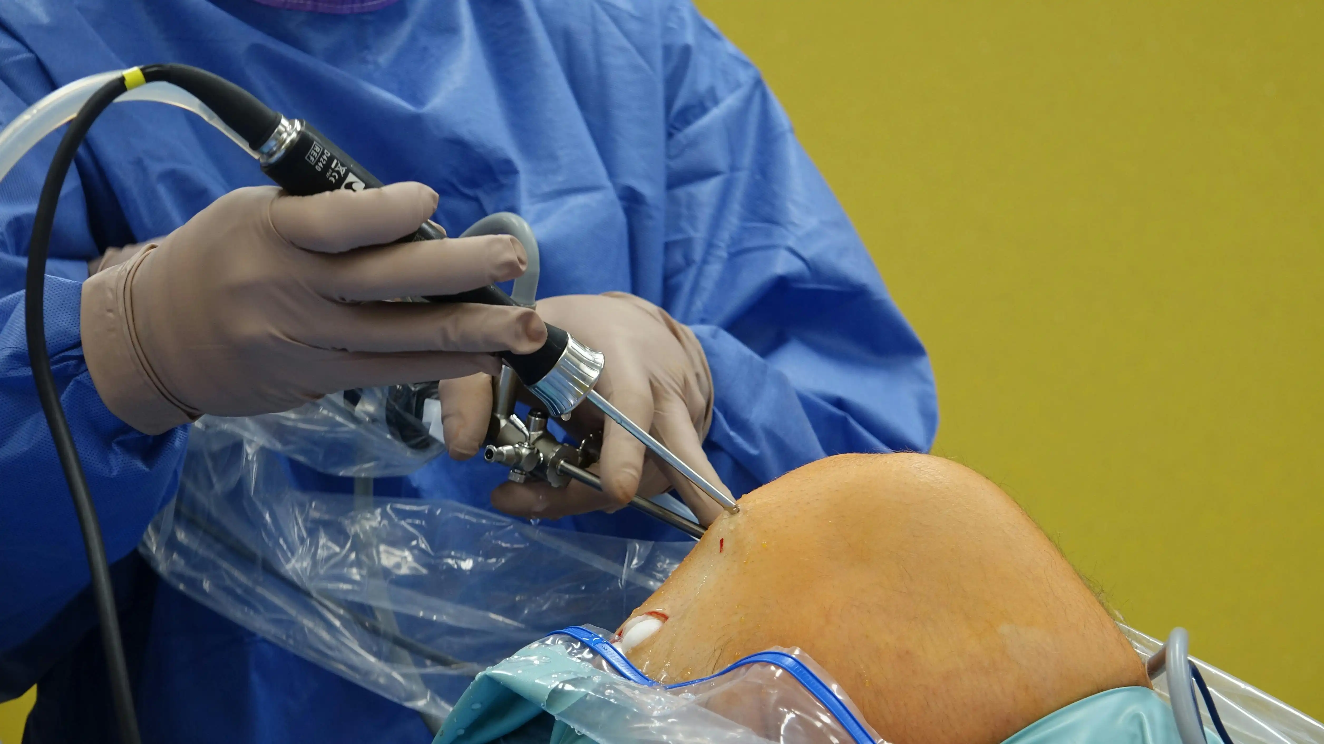 Mengenal Cedera ACL dalam Futsal, Ini Penyebab, Cara Mencegah, dan Proses Pemulihannya