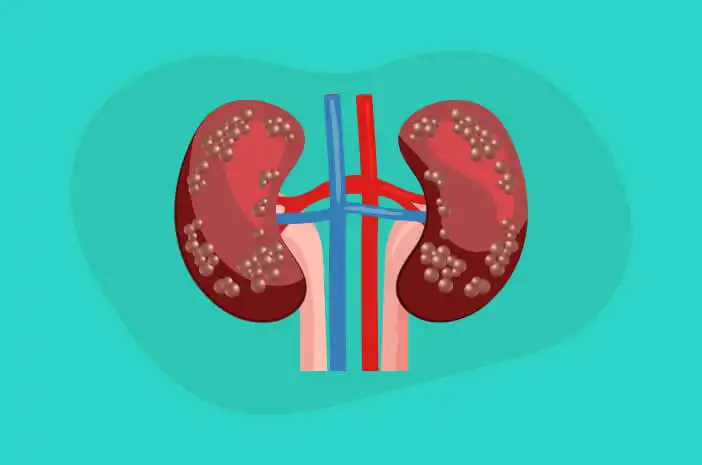 Silent Killer! Alasan Medis Kenapa Darah Tinggi Bisa Bikin Ginjal "Pensiun" Dini