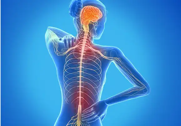 Mengenal Sklerosis Ganda, Penyakit Saraf yang Menyerang Otak dan Sumsum Tulang Belakang
