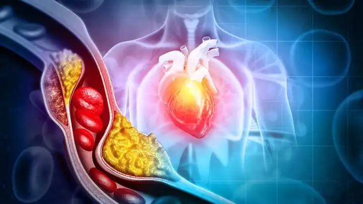 Sering Pusing Setelah Makan Daging? Ini Tips Alami Menjaga Kolesterol Tetap Aman