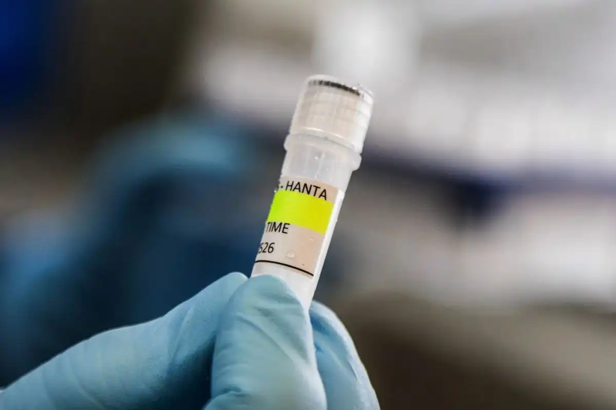 Waspada Lonjakan Hantavirus, Begini Cara Membedakan Gejalanya dengan Flu Biasa