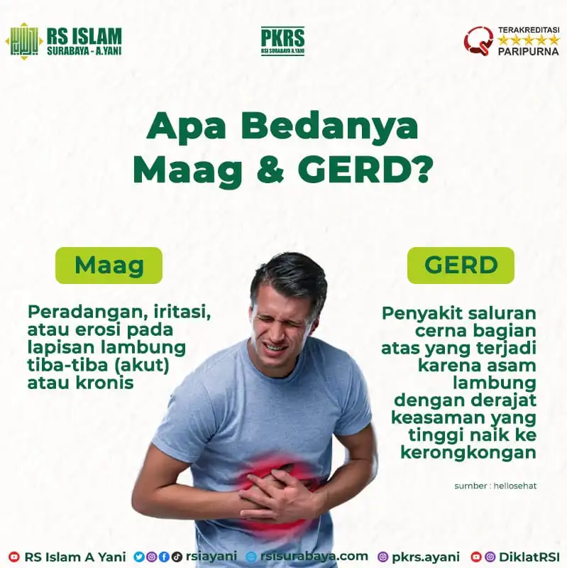 Mudah Bedakan Maag dan GERD: Tips Sehari‑Hari Dari Pengalaman Nyata