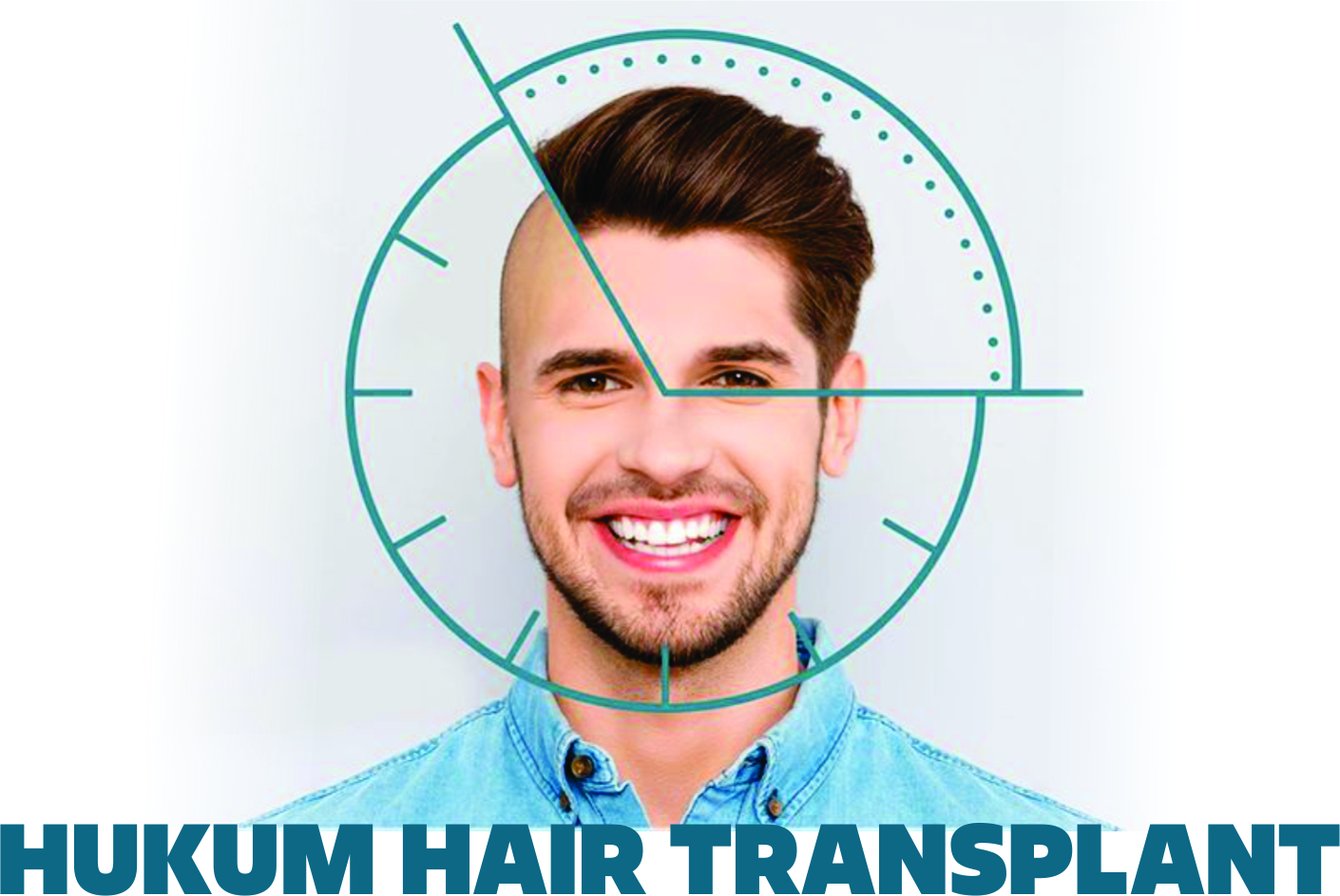 HUKUM HAIR TRANSPALANT